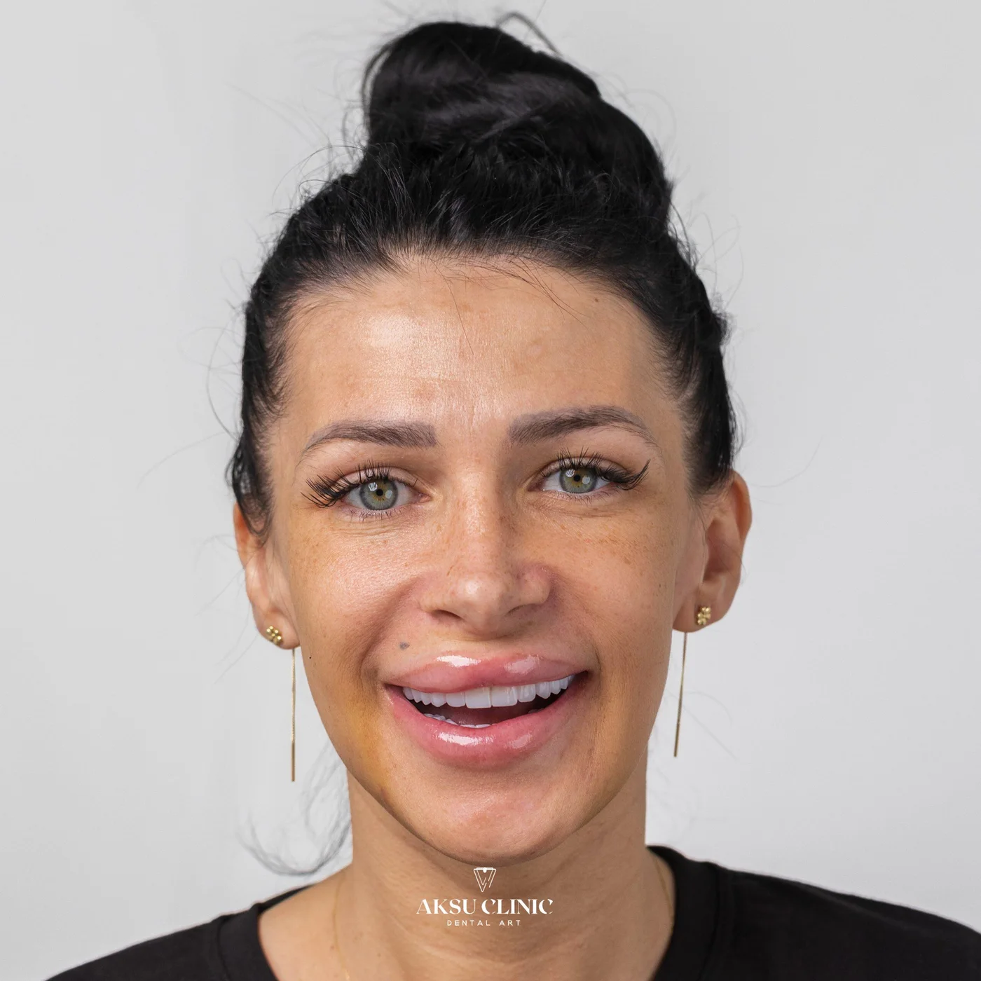 Aksu Clinic hasta portresi