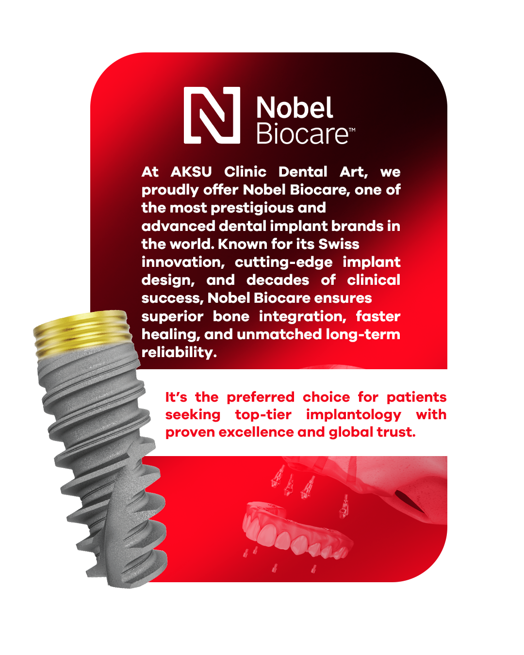 Nobel Biocare implant sistemi