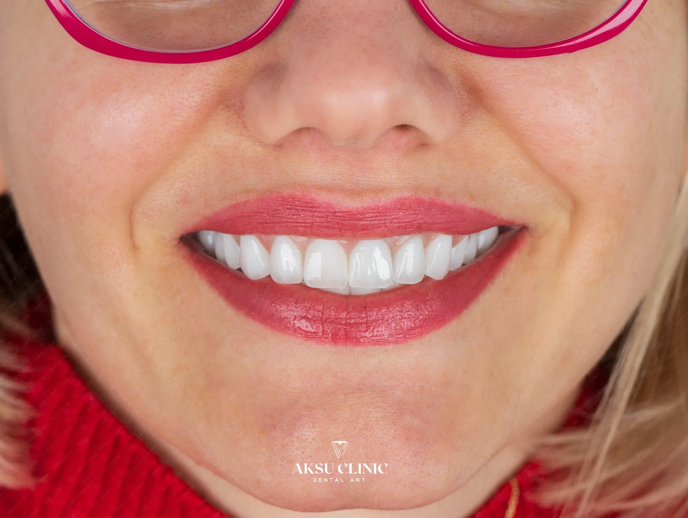 Ioana Roxana klinik hasta kaydı 6