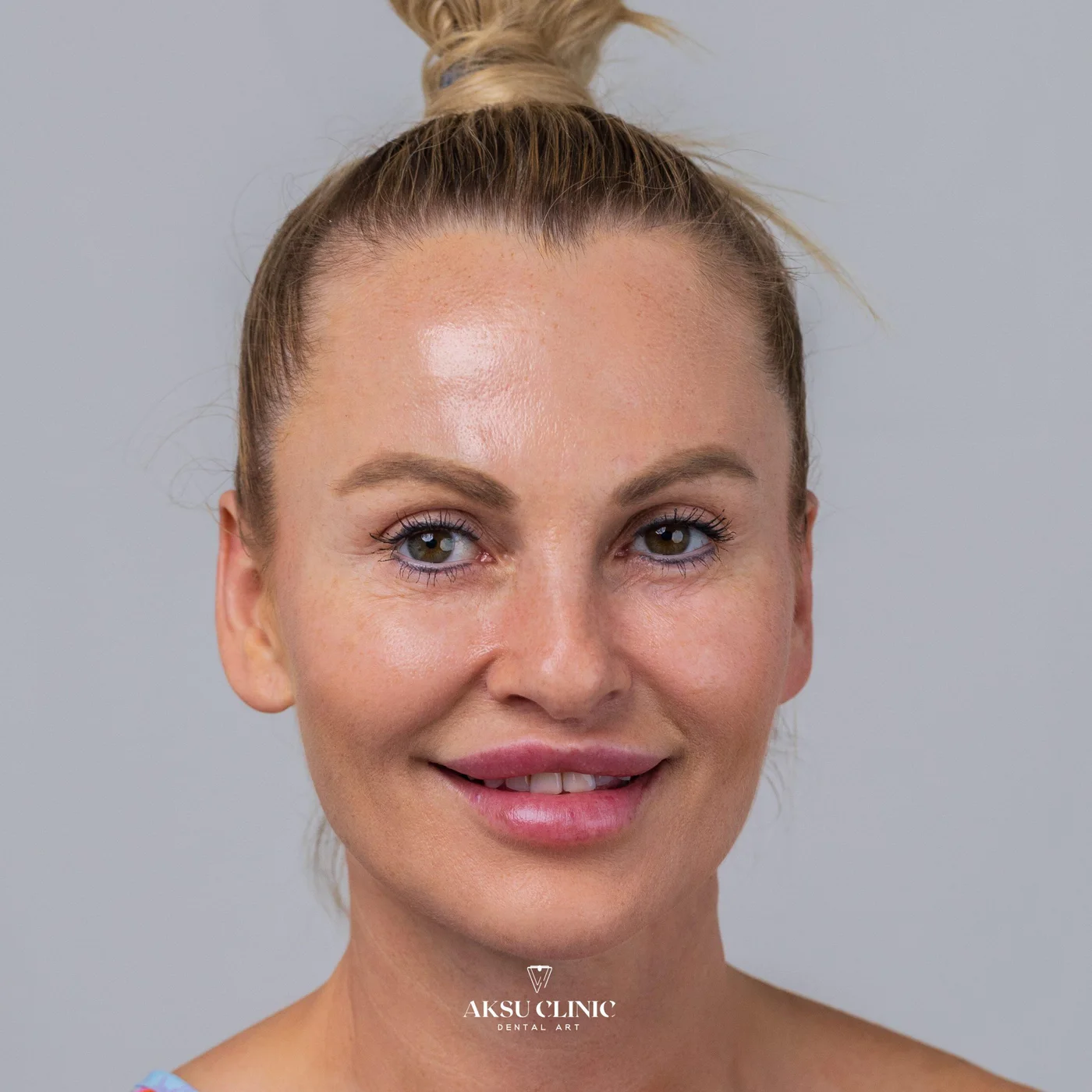 Magdalena Maximovic klinik hasta kaydı 1