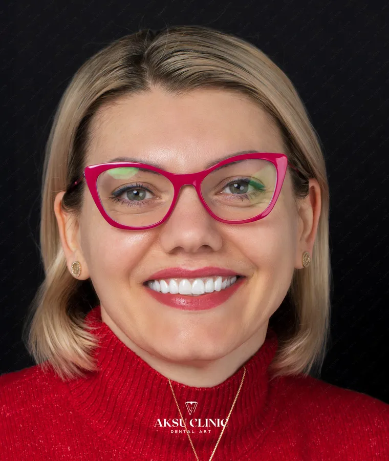Aksu Clinic hastası Ioana Roxana'nın doğal gülüş portresi