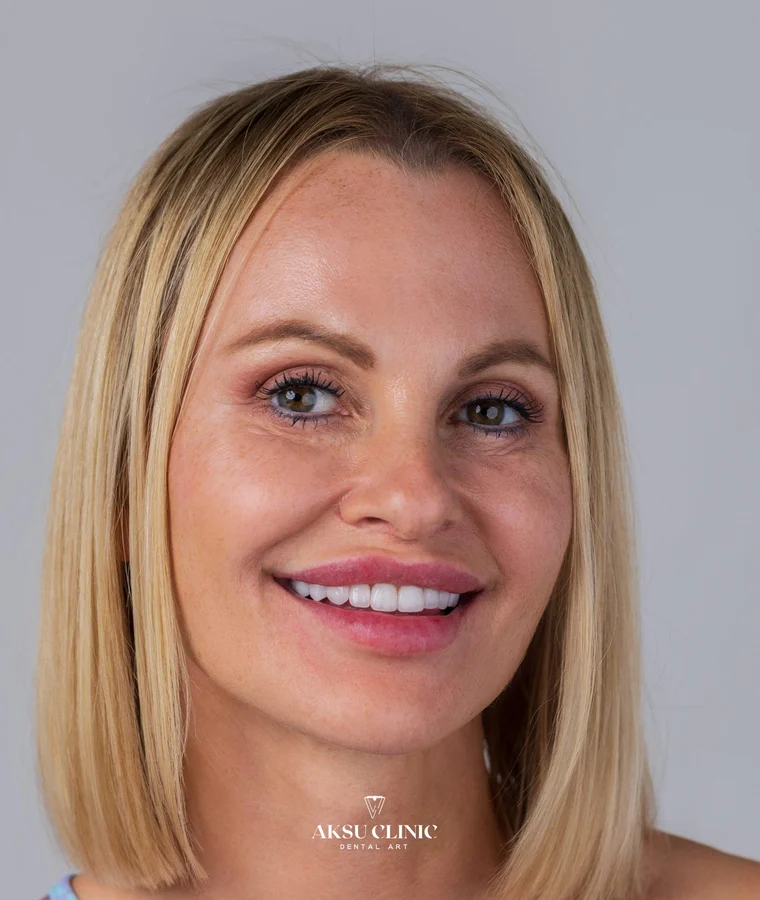Aksu Clinic hastası Magdalena Maximovic