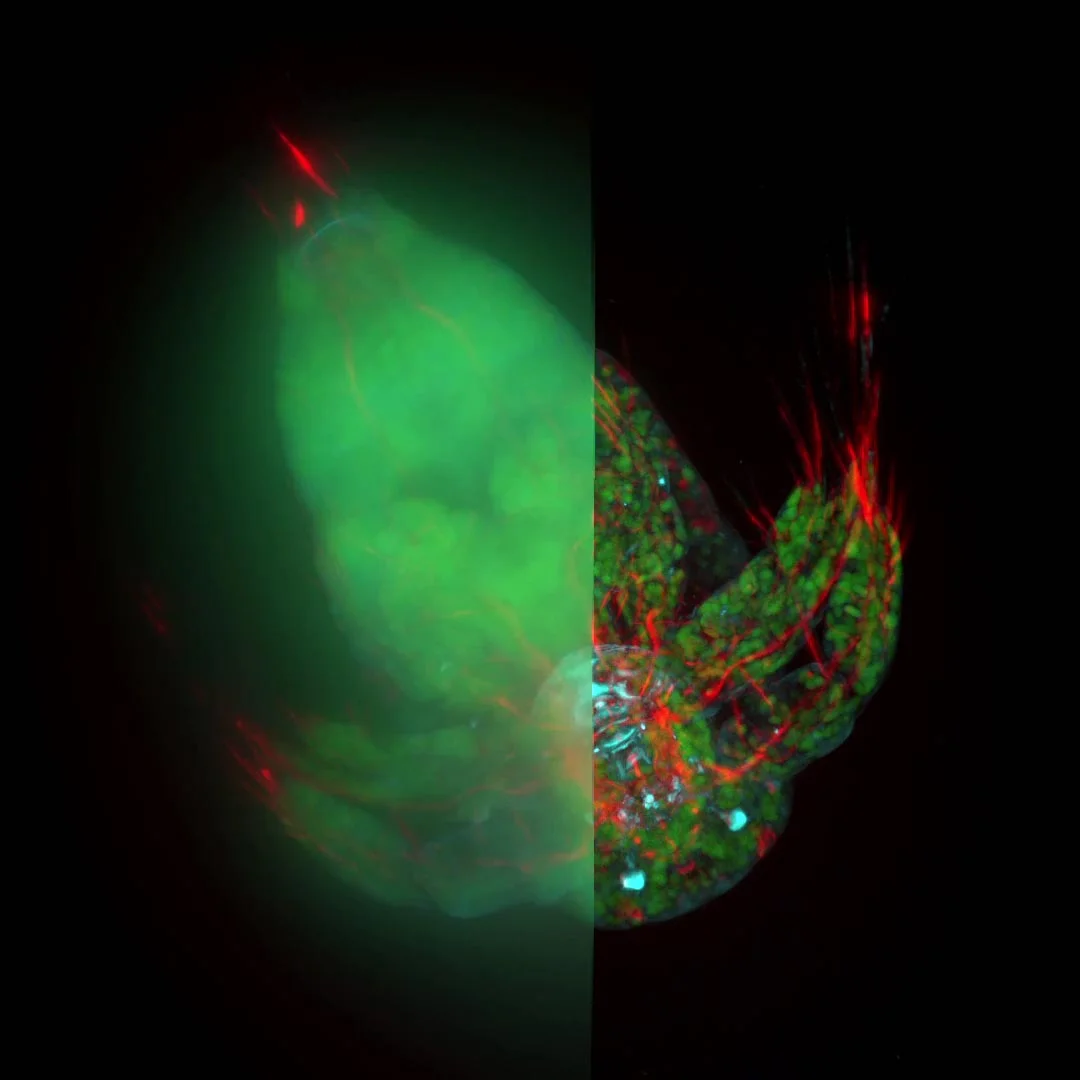 THUNDER Imager Tissue